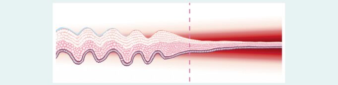 mucosa vaginal antes y después de la menopausia